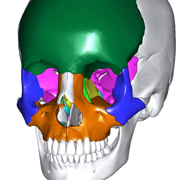 眼窩の壁をつくる骨